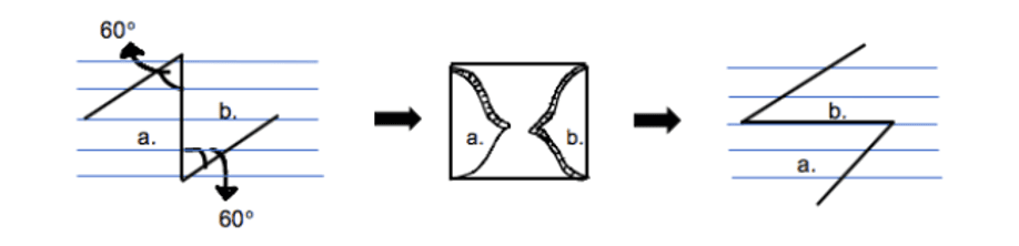 The Z-Plasty procedure shown with the transposition of the two flaps. The initial line is perpendicular to the Langer lines. 