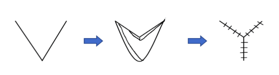 The Z-Plasty procedure shown with the transposition of the two flaps. The initial line is perpendicular to the Langer lines. 