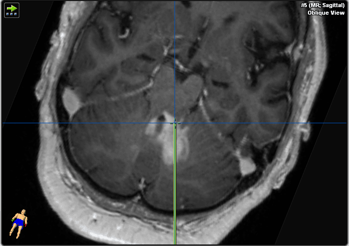 Fig.3b