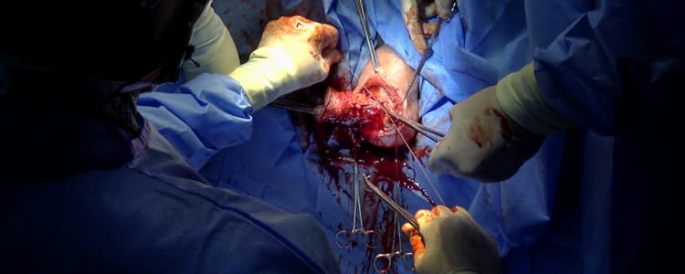 Vaginal-Hysterectomy-Uterosacral-Ligament-Suspension-and-Excision-of-Redundant-Vaginal-Tissue
