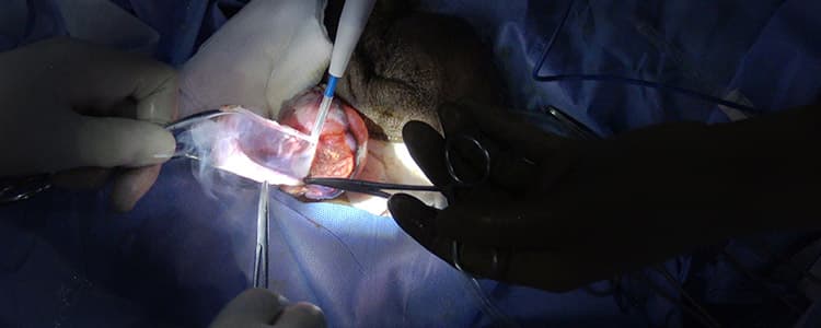 bilateral-simple-hydrocelectomy-and-removal-of-subdermal-implants